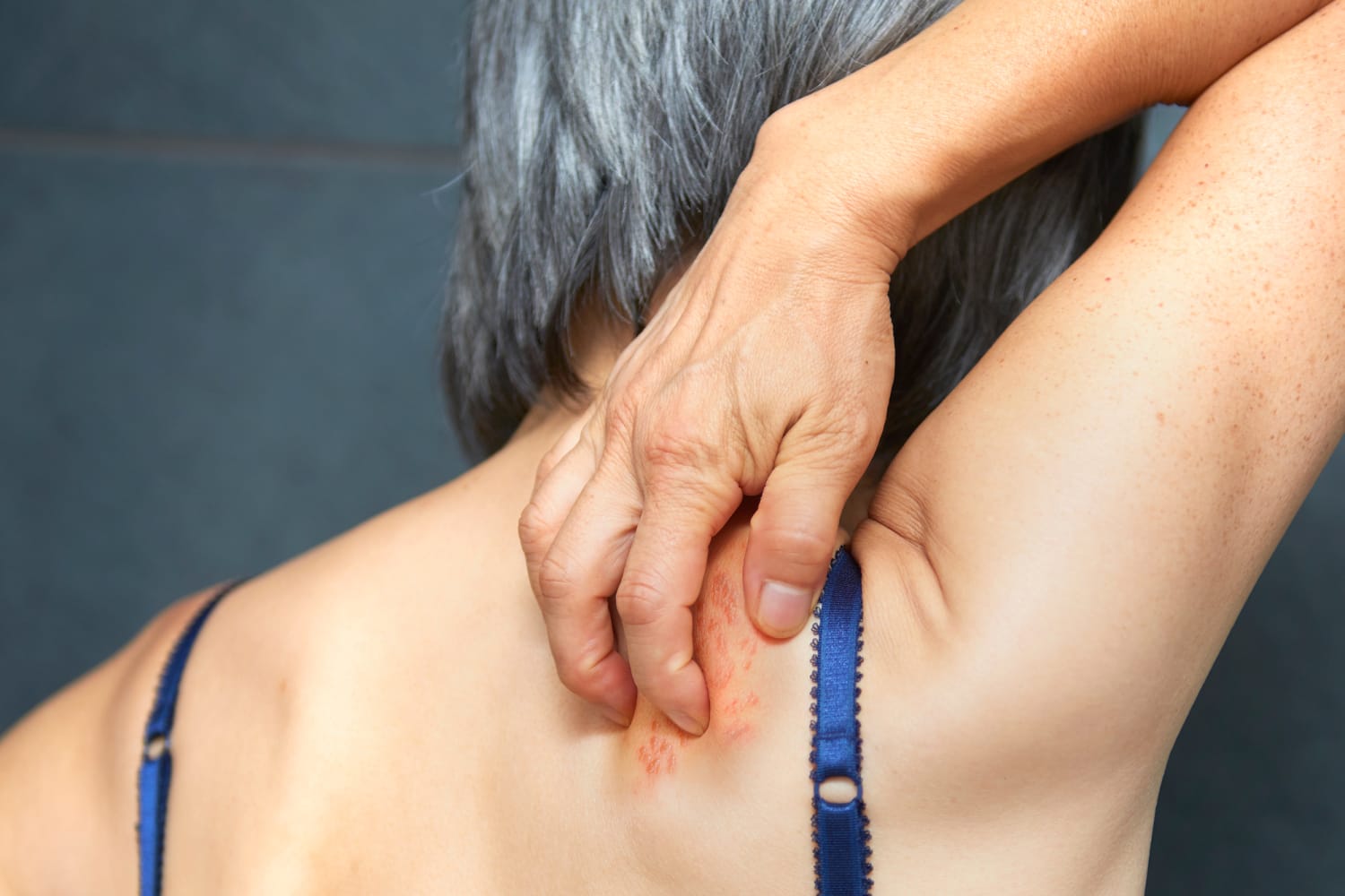 long term effects tirzepatide Tirzepatide Side Effects. What You Shouldn't Ignore