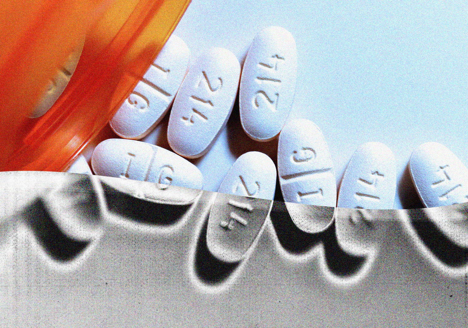 Could cancer drugs be the future of Alzheimer's treatment?