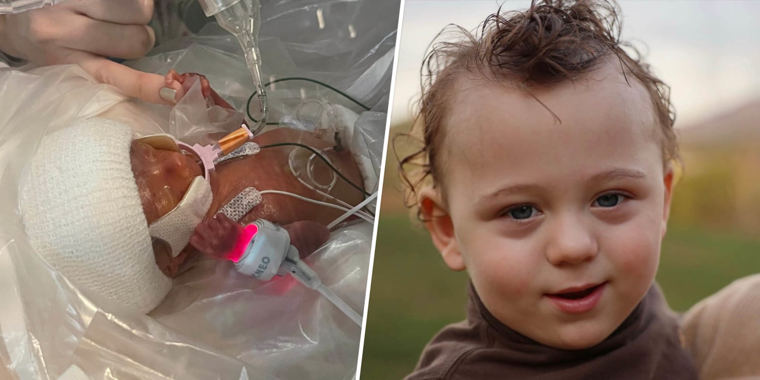 Toddler Born at 22 Weeks Is a 'Miracle' … And He Has the Perfect Name