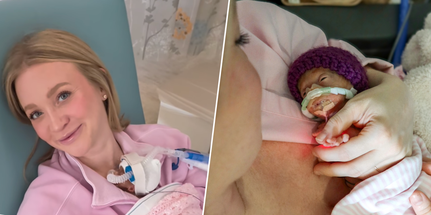 She Was Told Her Tiny Baby Wouldn't Survive. But This Mom Believed: 'That's Not Going to Be Our Story'