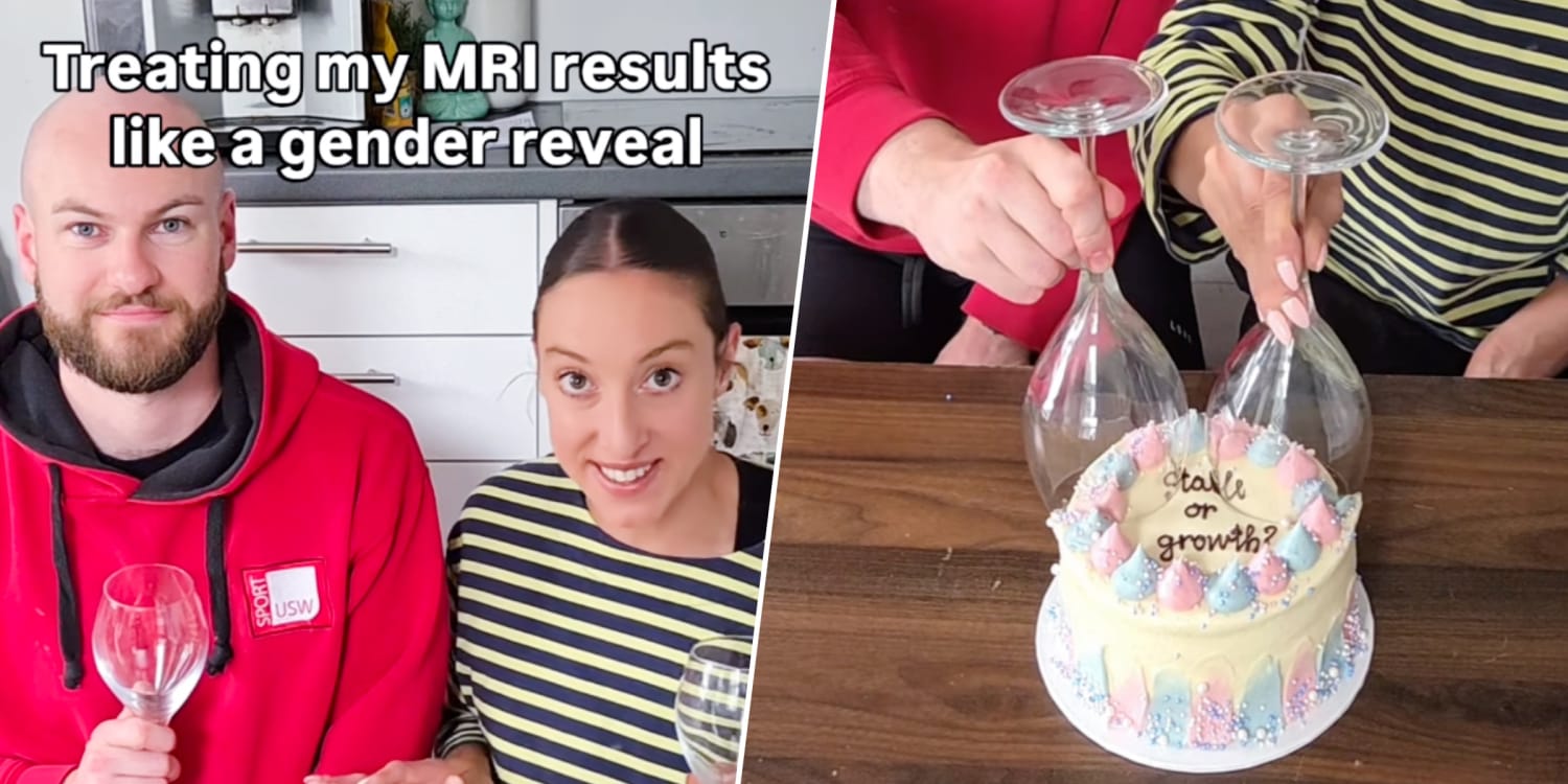 Woman With Brain Cancer Finds Out MRI Results With ‘Gender Reveal’ Cake: ‘Stable or Growth?’