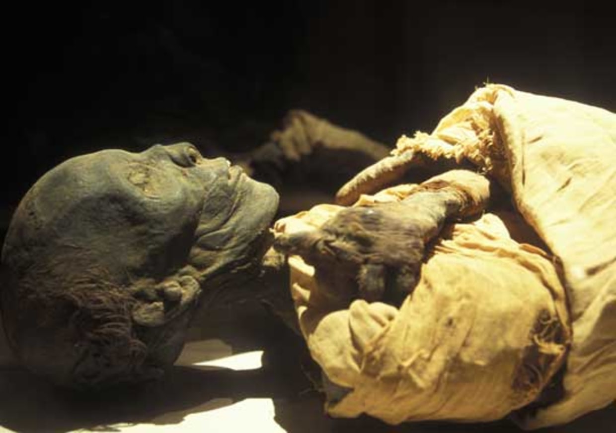 Leg mummified with ancient Egyptian recipe