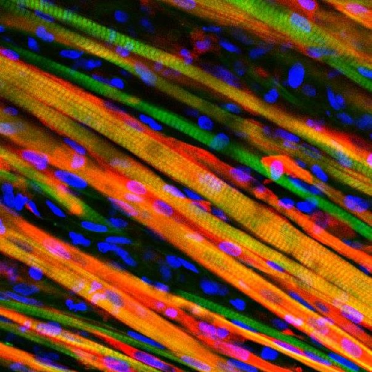 Scientists Grow Muscles in the Lab That Can Heal Themselves