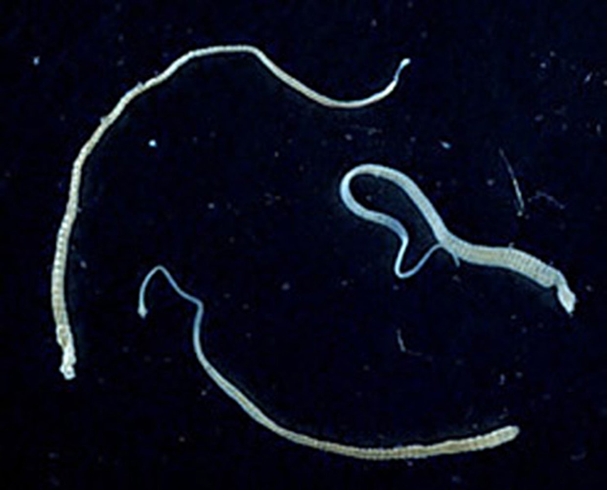 Ленточные черви паразиты карликовый цепень