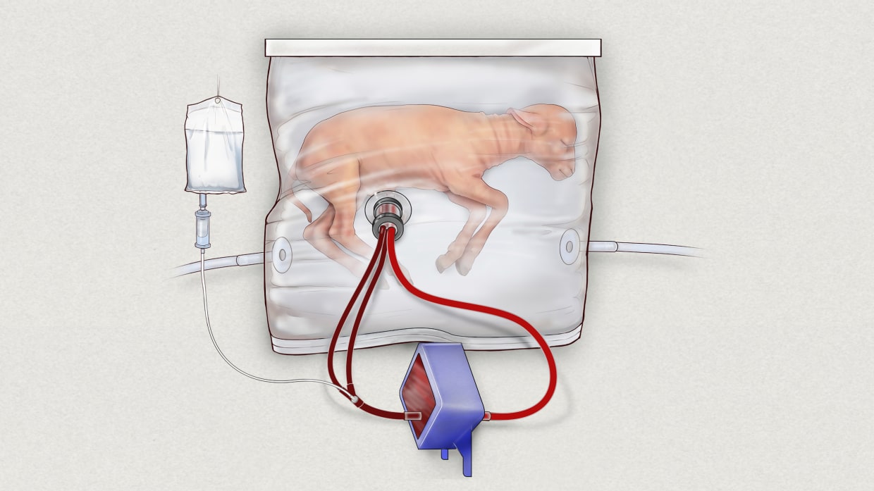 170425-preemies-artificial-womb-ew-126p-1977081.jpg
