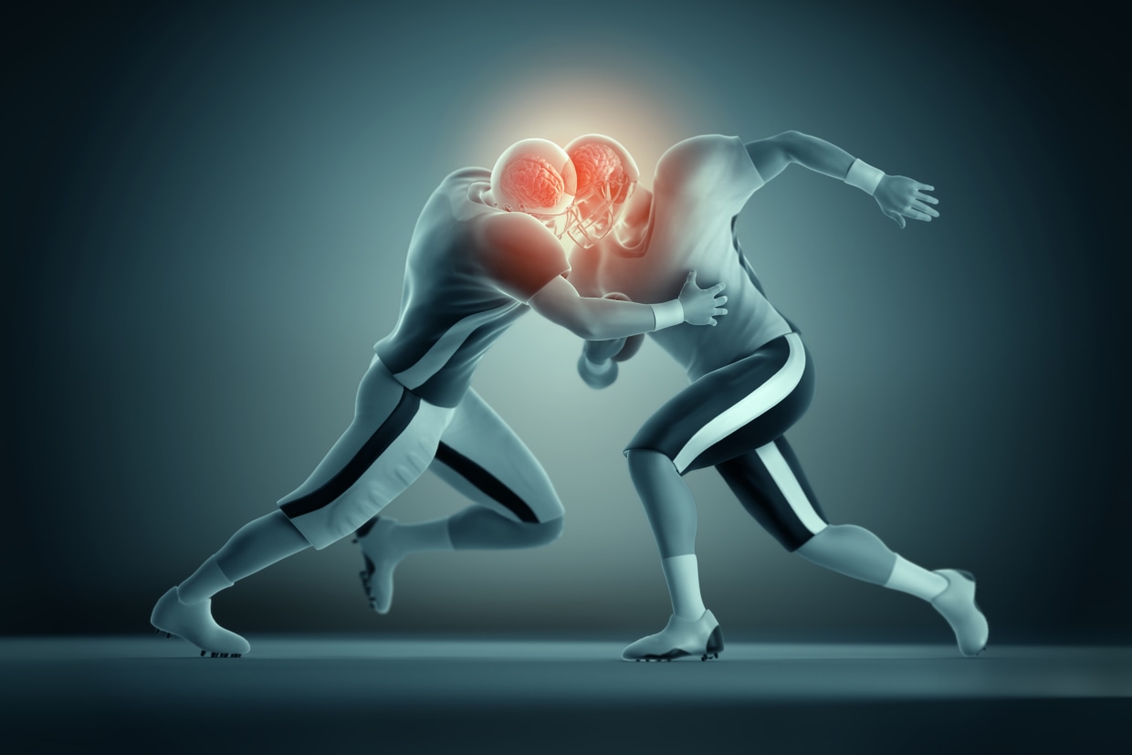 Back in the Game: Why Concussion Doesn't Have to End Your Athletic