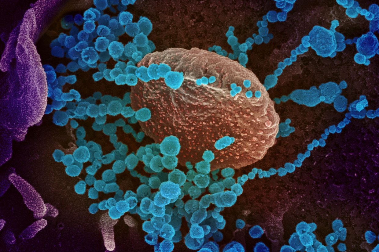 How SARS-CoV-2 hijacks human cells to evade i