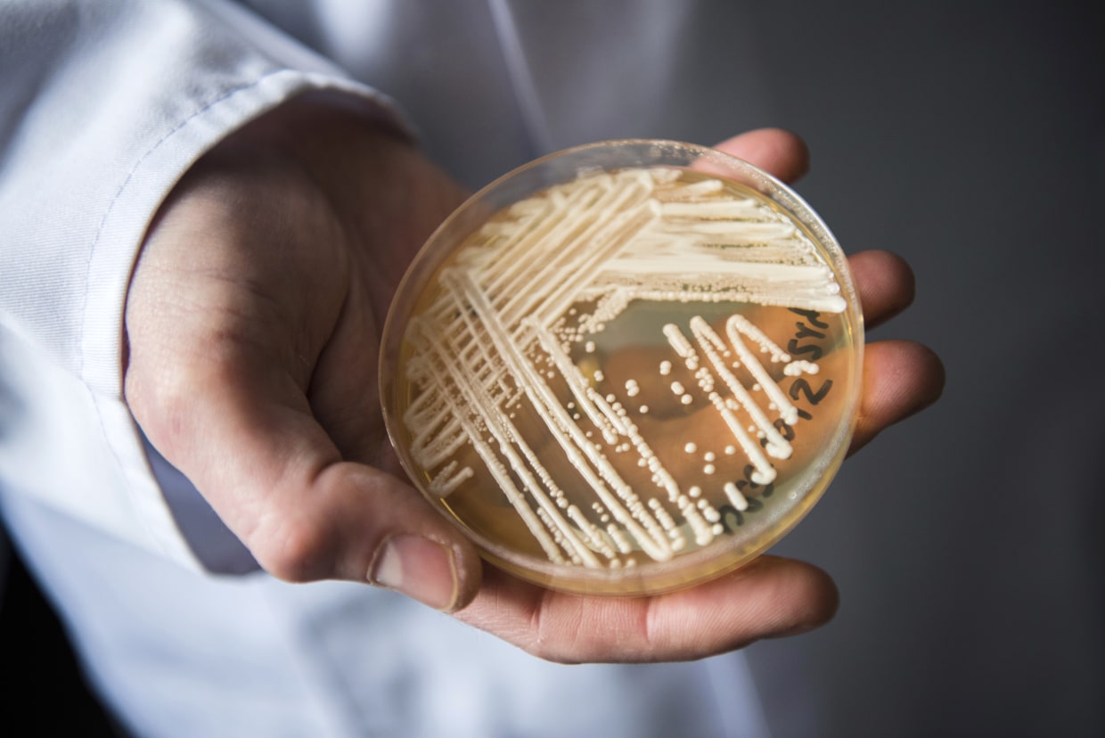 'Superbug' fungus spread in two cities, health officials say