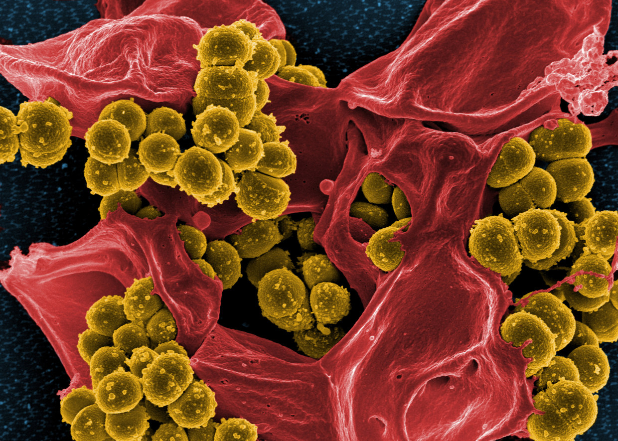 Drug-Resistant Superbug Infections Spiked During First Wave of Coronavirus Pandemic