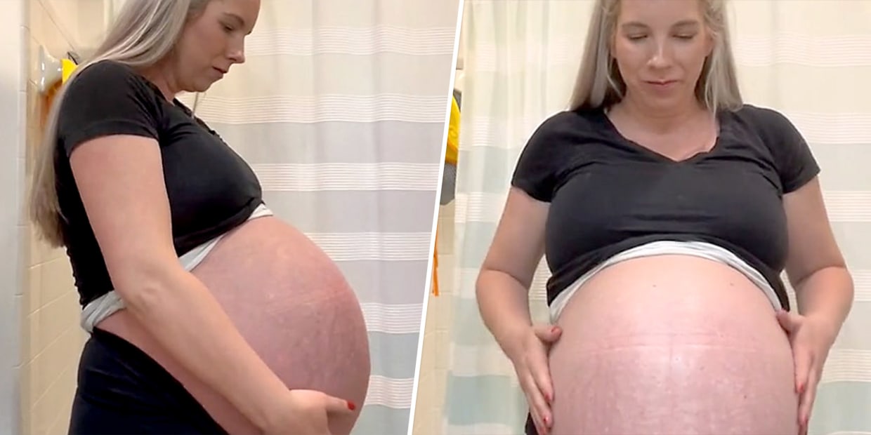 contraction belly shape｜TikTok Search