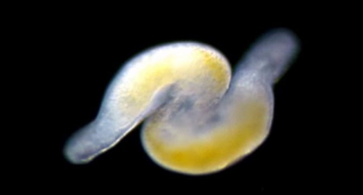 Balatkar Bf - Worm porn' sheds light on evolution of sperm