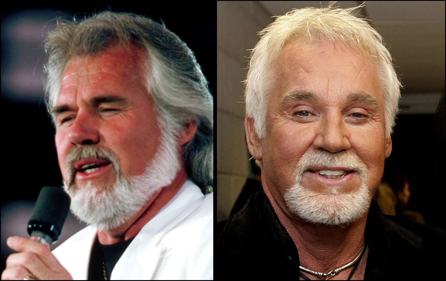 Kenny rogers sales plastic surgery