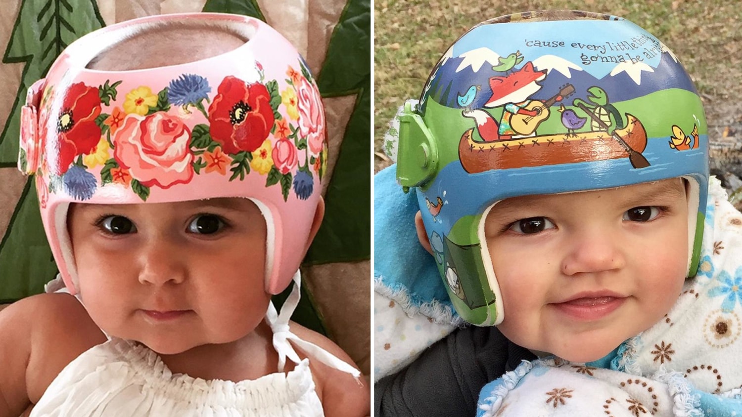 pizza fusie Praten tegen Artist turns babies' medical helmets into works of art