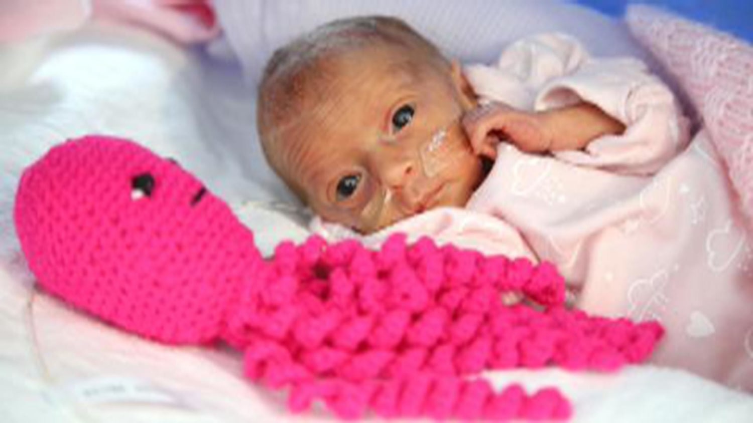 The most premature surviving baby was born at 21 weeks