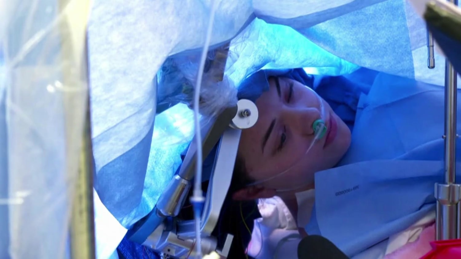 Woman's awake brain surgery livestreamed on Facebook