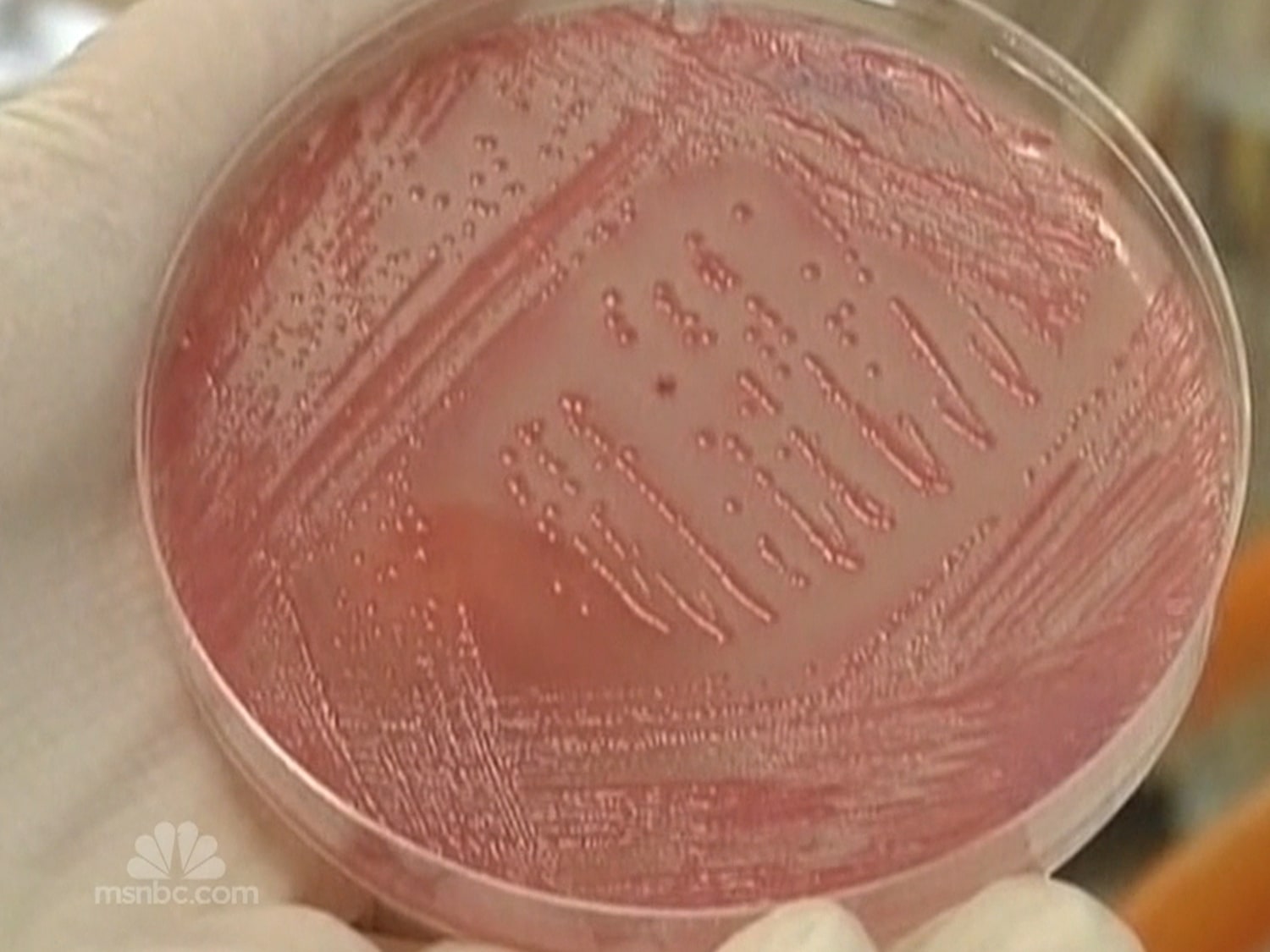 E. coli outbreak grows; source unknown