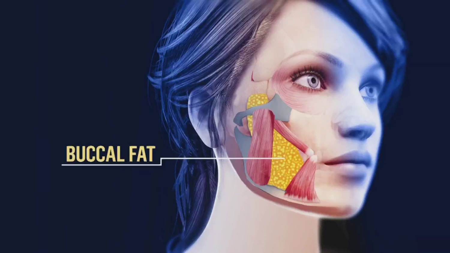 The Difference Between Buccal Fat Pad Removal and Cheek Liposuction: Which  One Is Right For Me? - CENTER for Advanced Facial Plastic Surgery