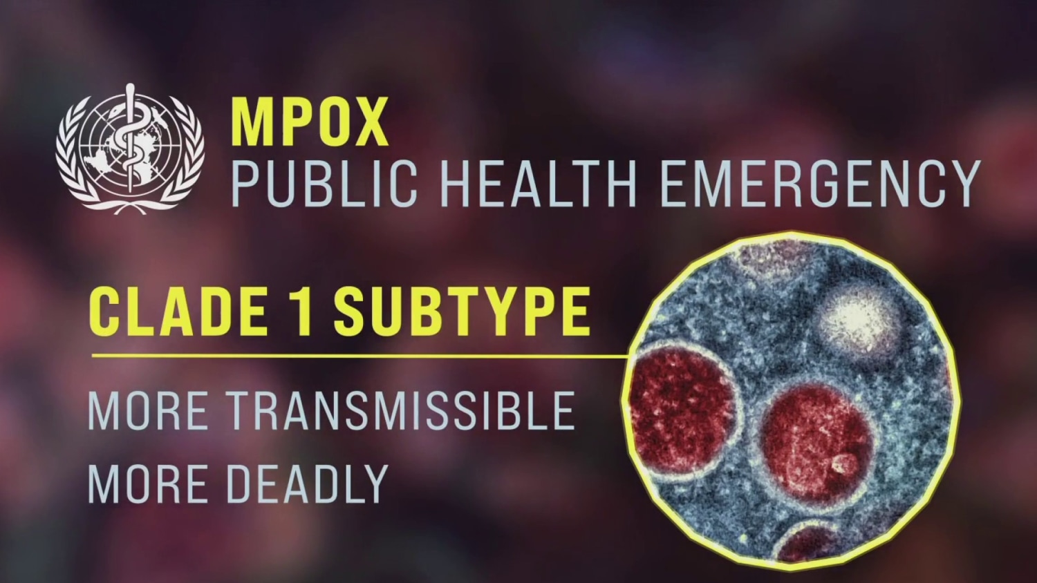 Could the new mpox threat cause significant harm in the U.S.?