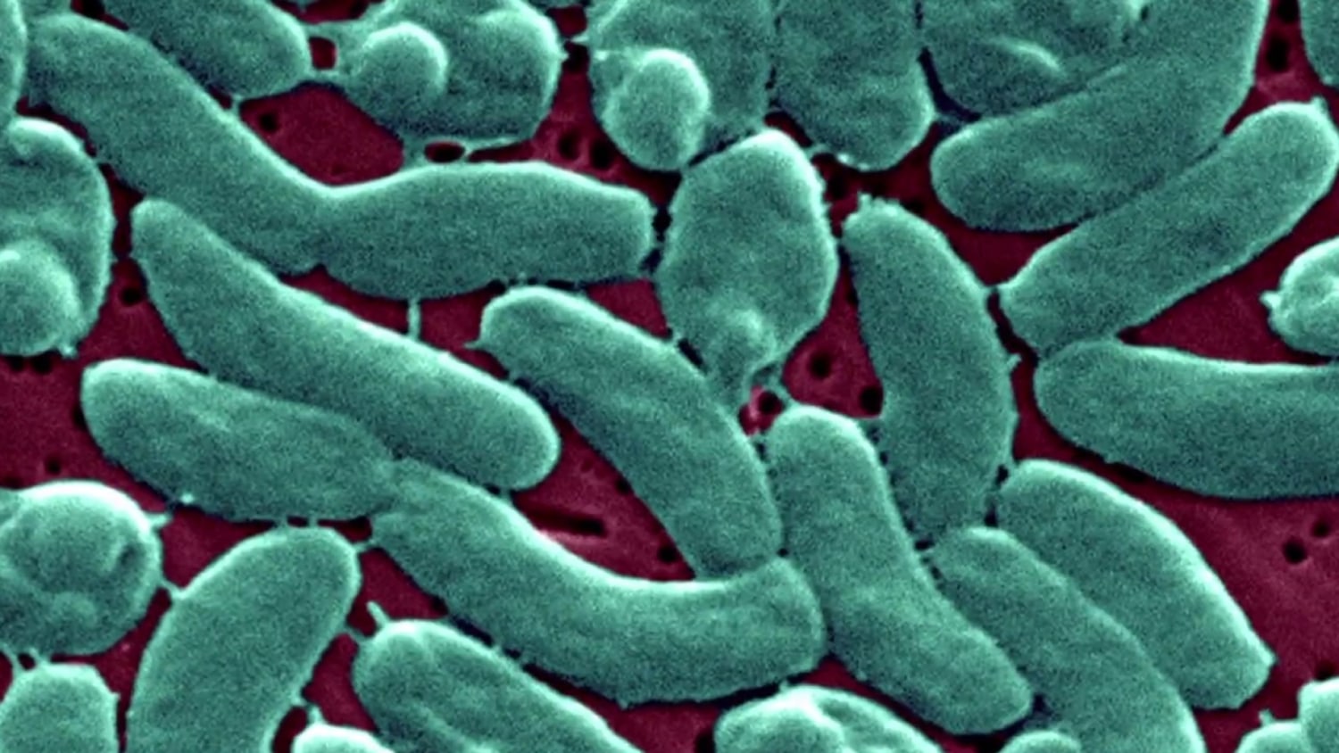 Deaths from flesh-eating bacteria are on the rise. Who is at risk?