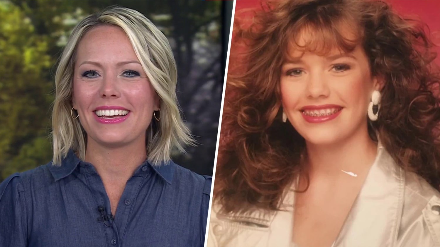 today show anchors with braces