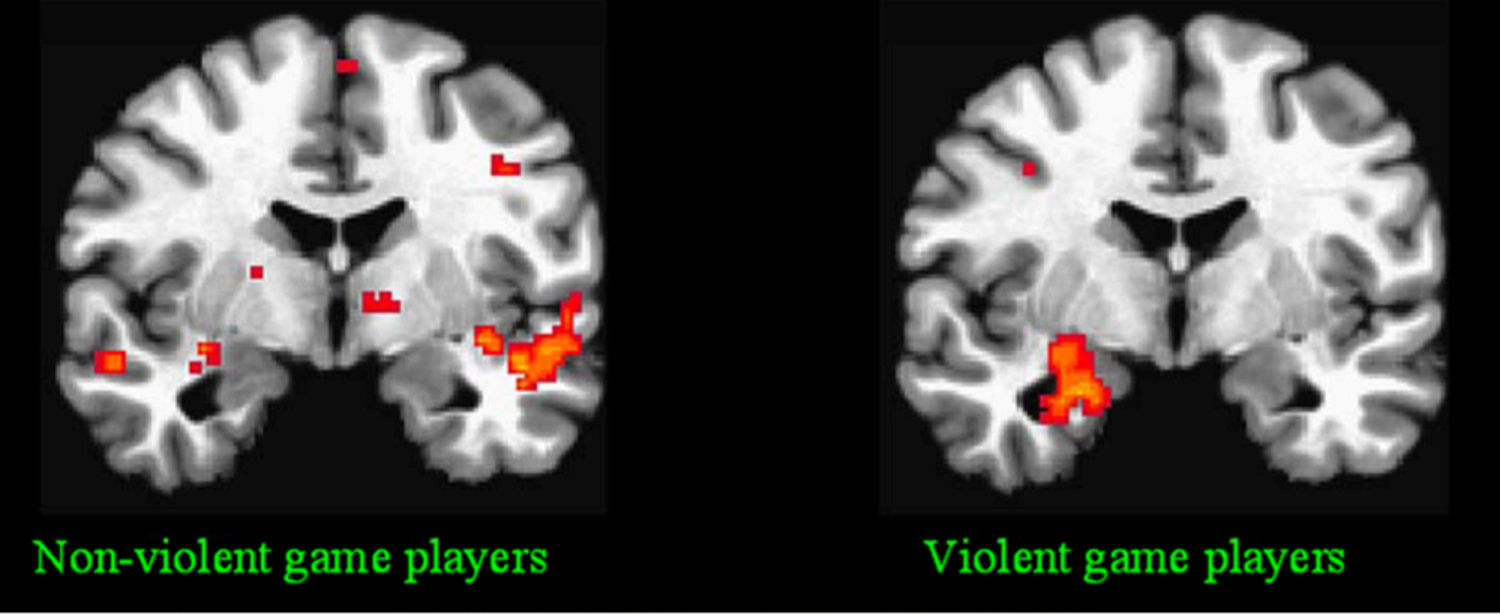 Effects of Video Games on the Brain