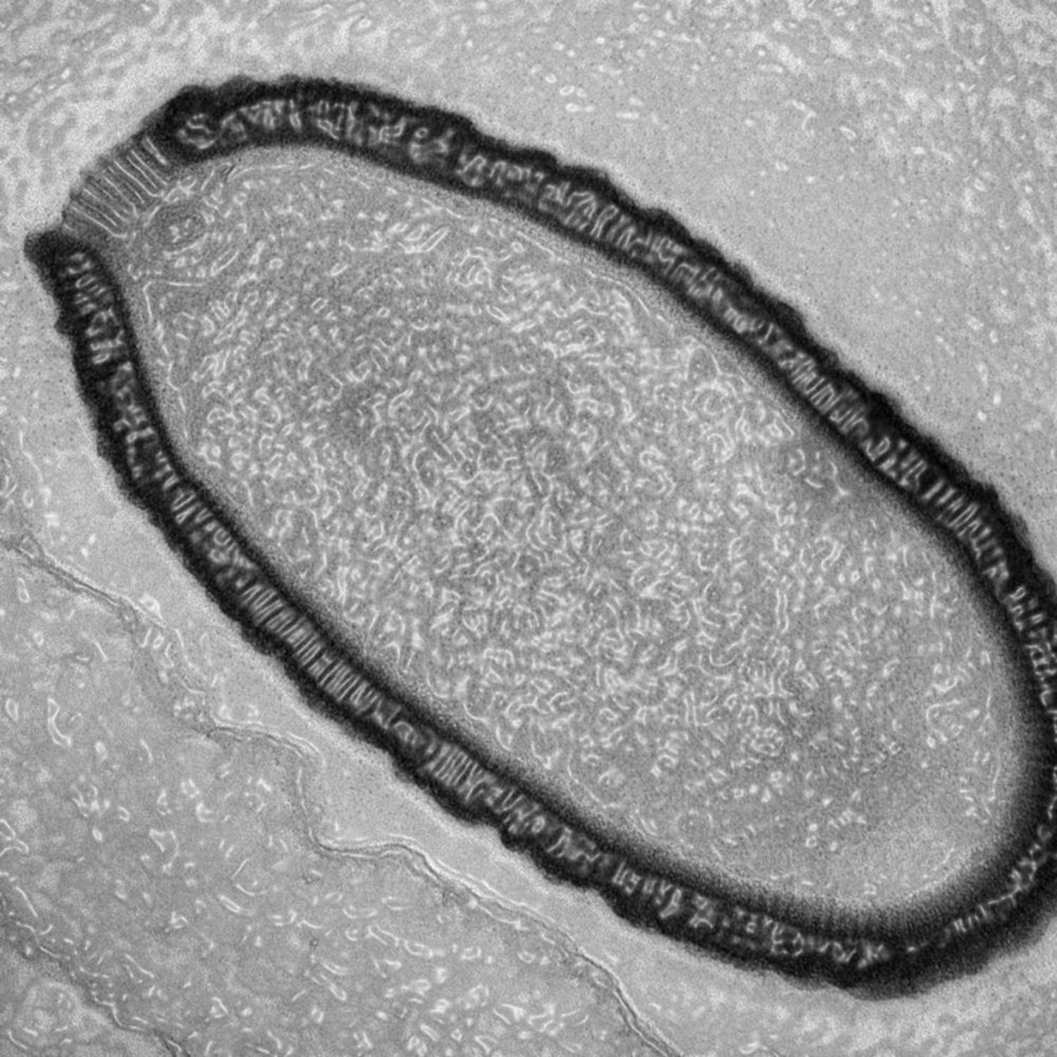 Giant Virus Resurrected From Siberian Permafrost After 30,000 Years