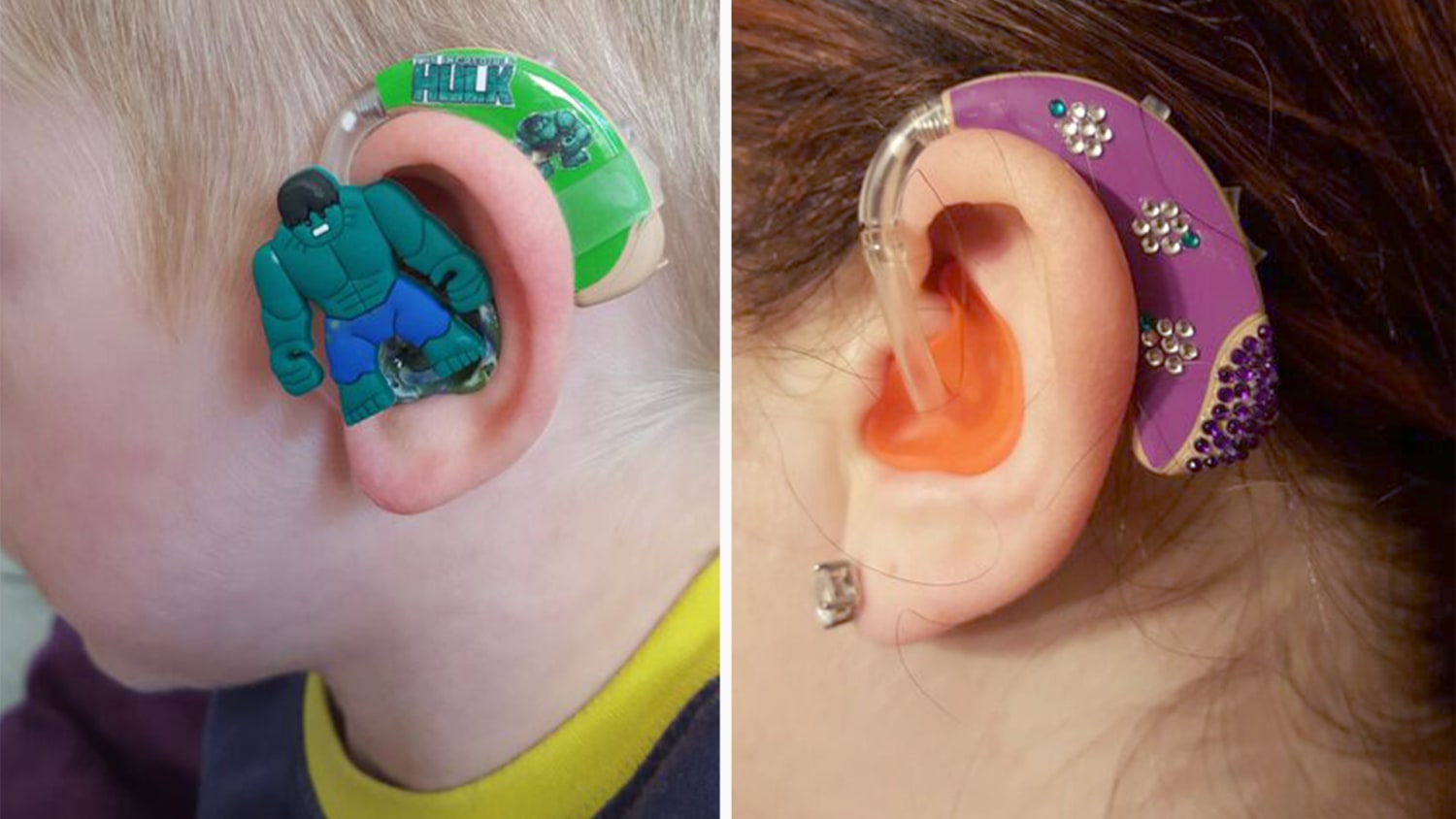 A Guide to Behind-the-Ear Hearing Aids