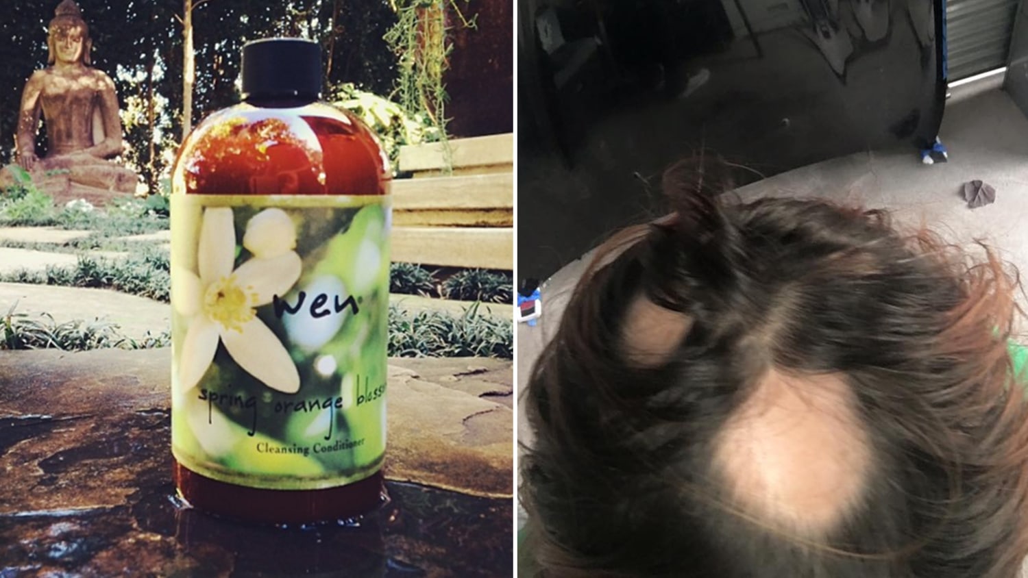 Fda Launches Wen By Chaz Dean Hair Loss Investigation