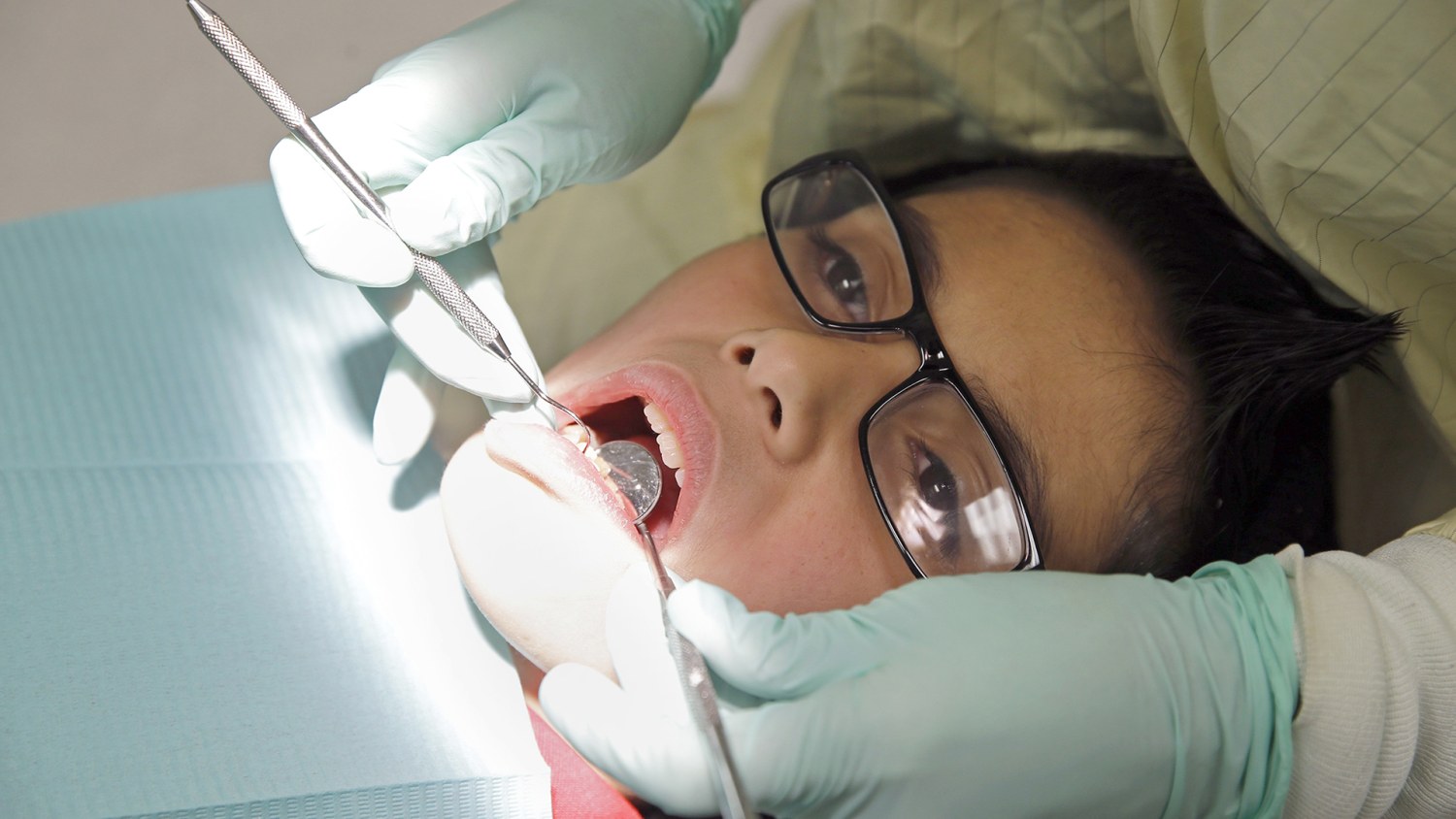 Should Your Teen S Wisdom Teeth Be Pulled Why Experts Disagree