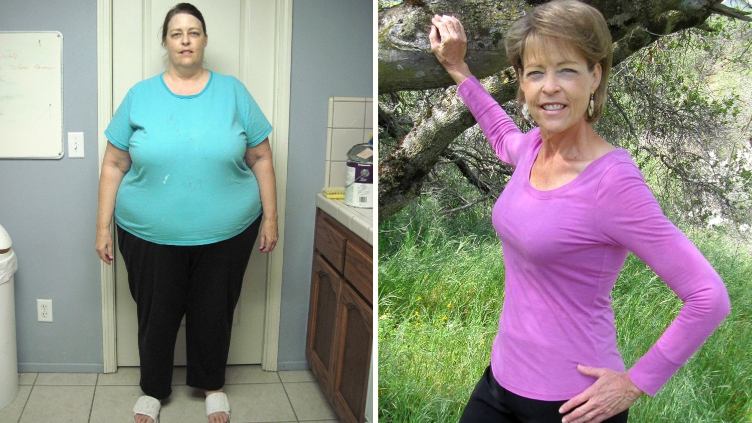 a 66-year-old woman with no history of massive weight loss is