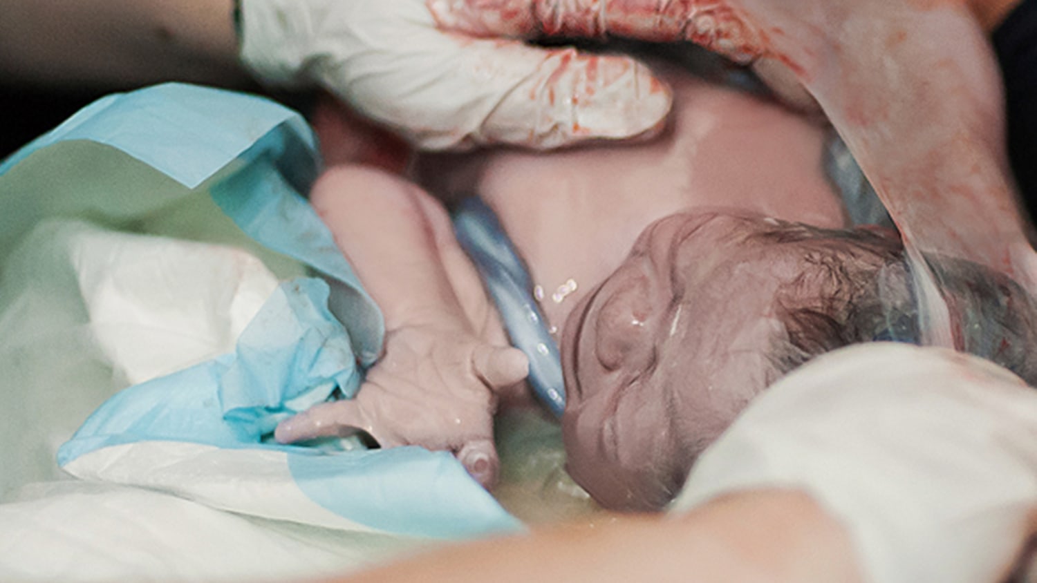 leje angivet dug 7 amazing photos of rare en caul births
