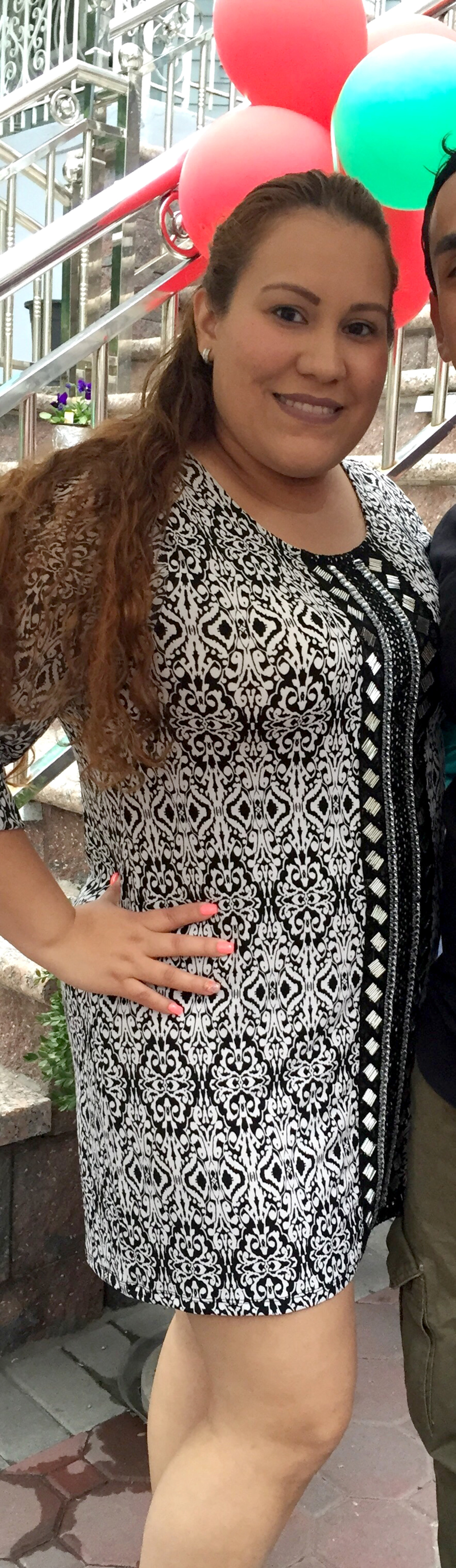 Sewing Machine Surgery Helps Weight