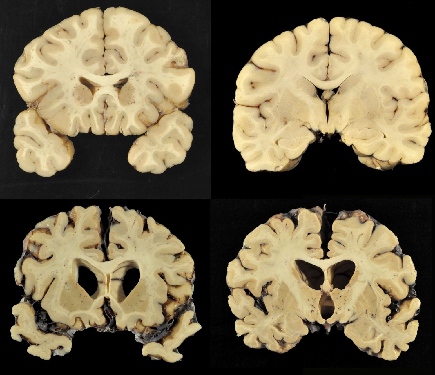The optimized brain of Michael Jordan - neuro11