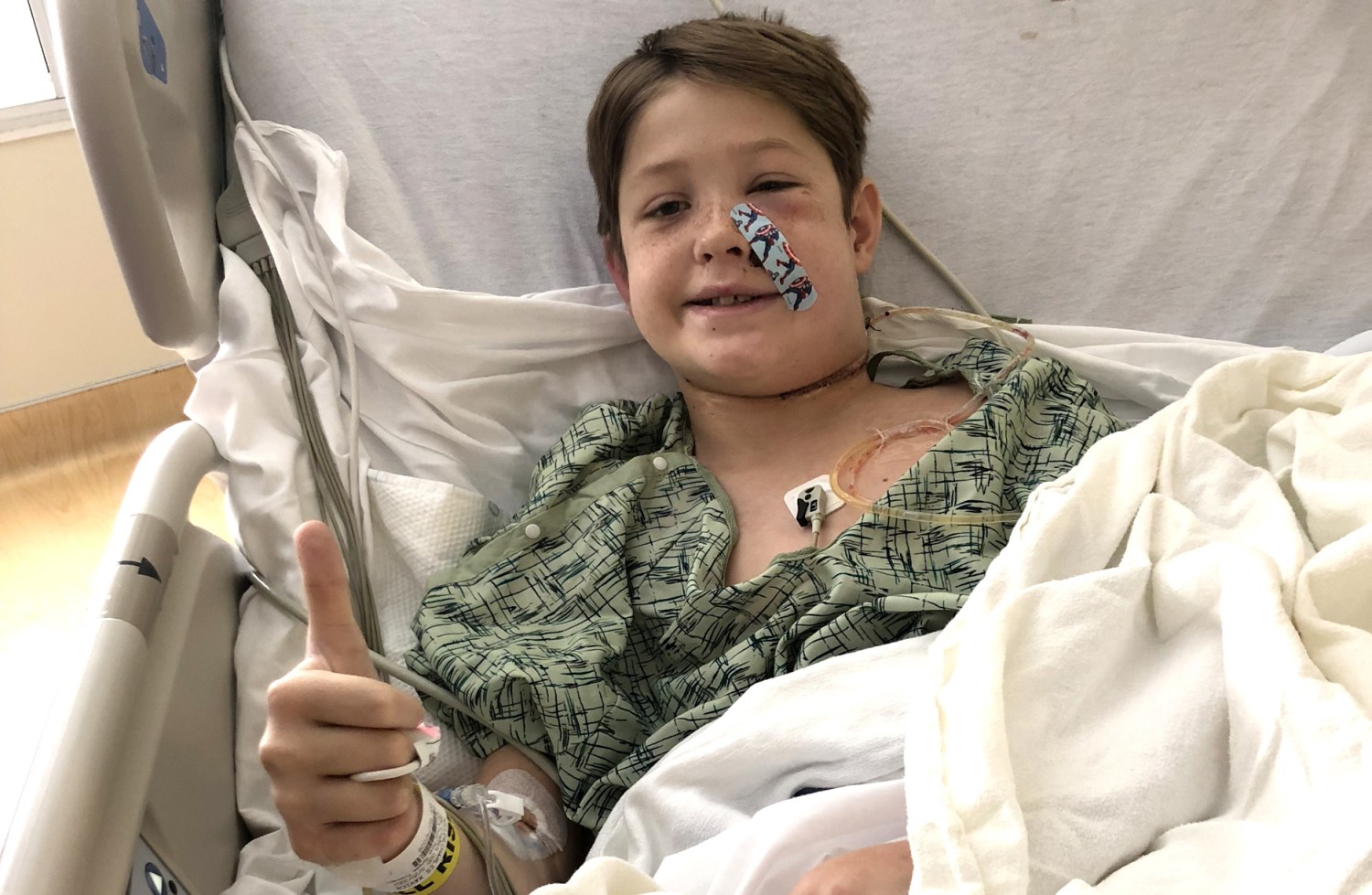 Missouri boy, 10, survives being impaled in the face by a metal