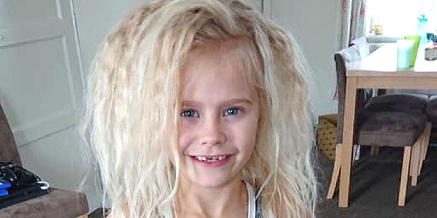 Uncombable hair syndrome: Condition gives girl unruly mane