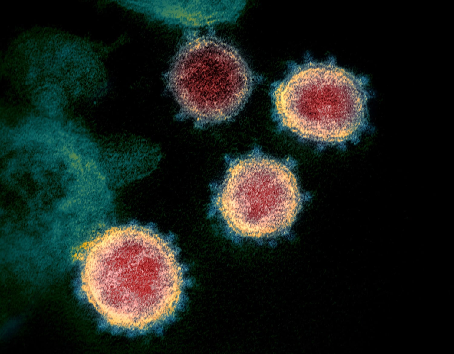 Pandemic Protagonists: Viral (Re)Actions In Pandemic And Corona