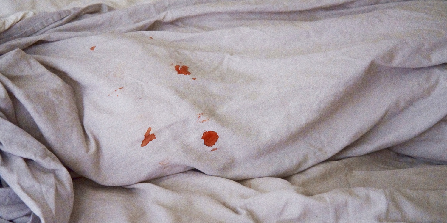 How to Get Blood Out of Sheets or Clothing: A Stain Removal Guide