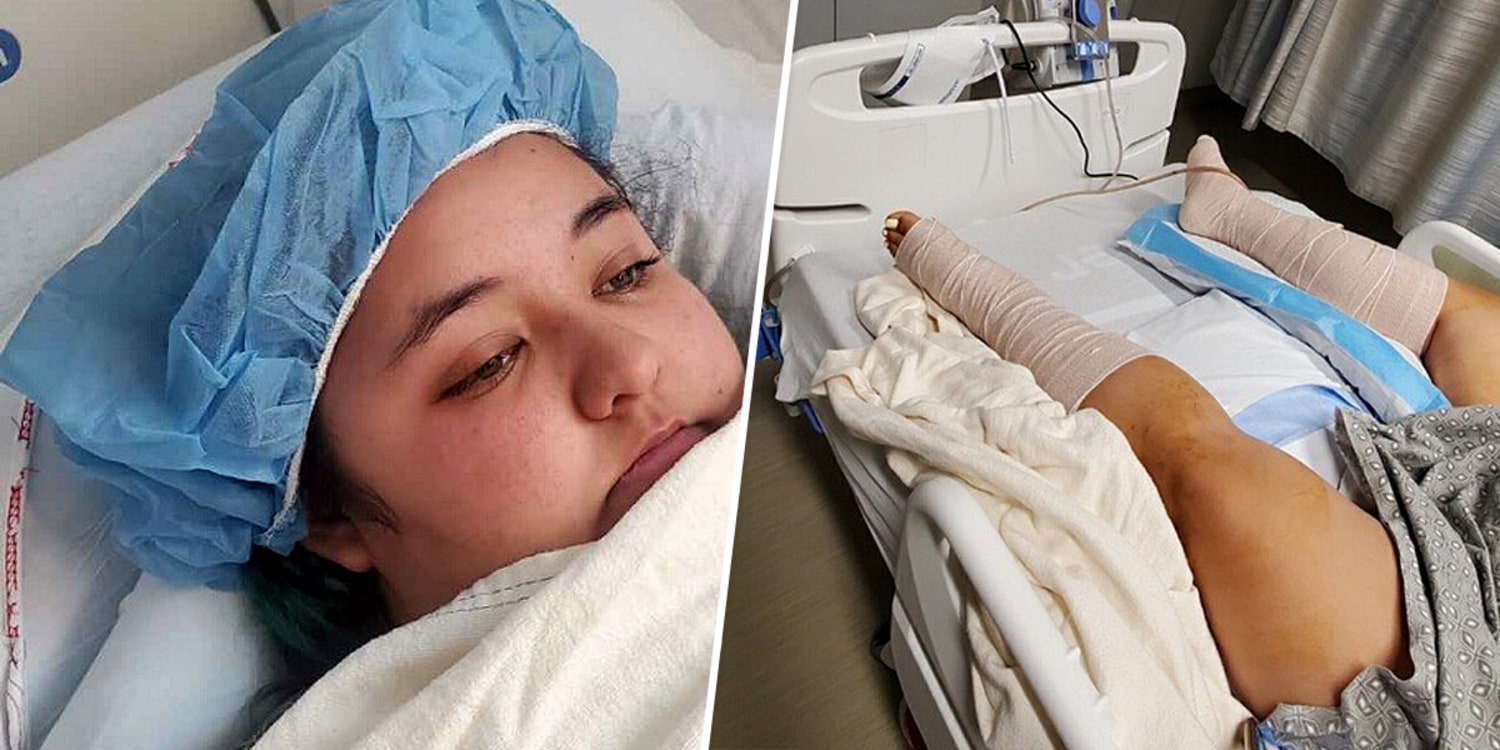 California teen attacked by crocodile in Mexico is 'grateful' to those who  saved her
