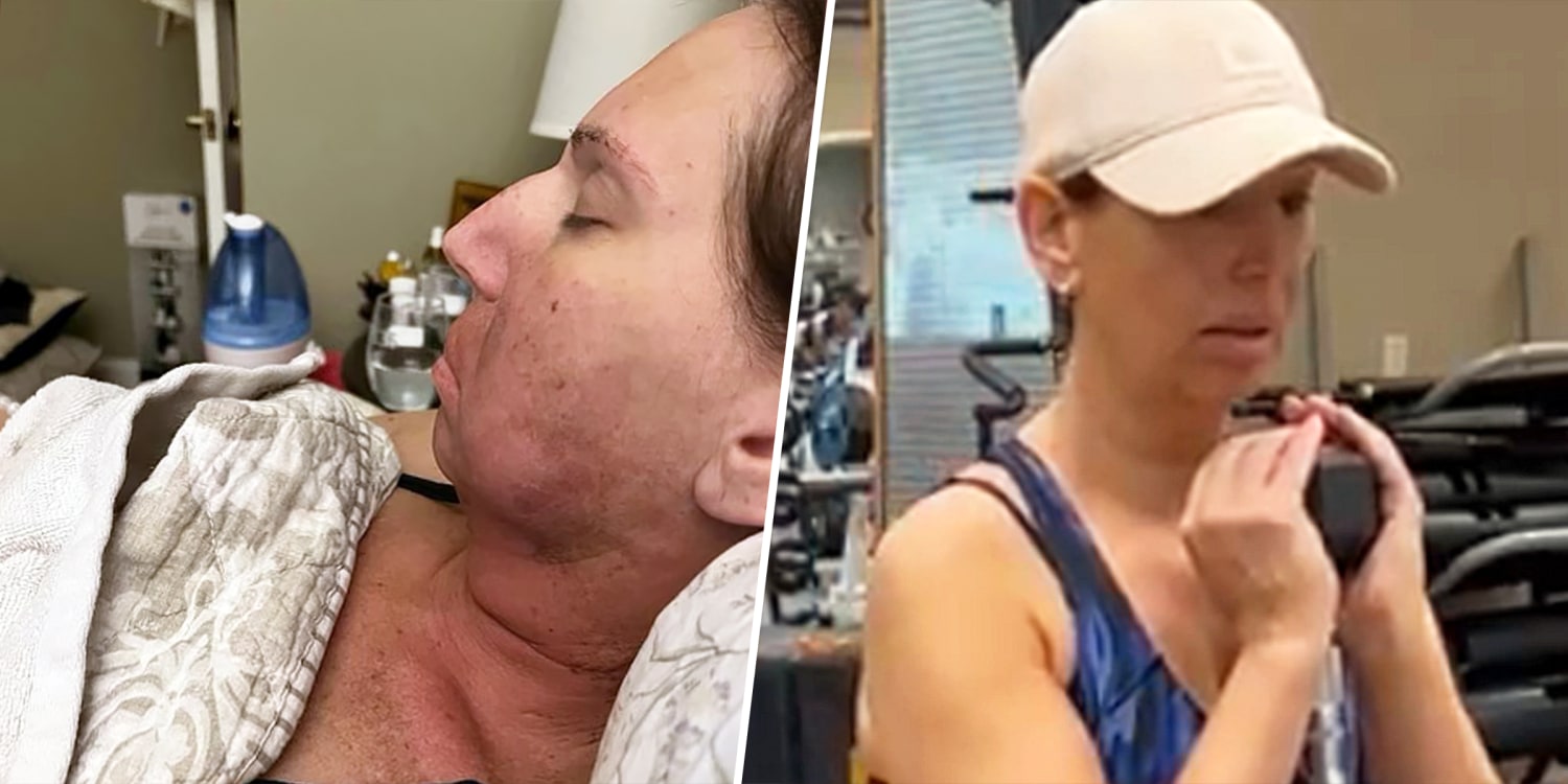 After Mouth Cancer, Fitness Helps Woman Find Strength After Chemo