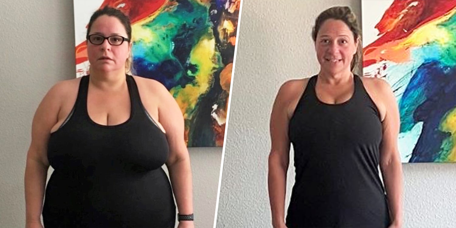 Woman Loses 150 Lbs With Gastric Sleeve Surgery, High-Protein Diet