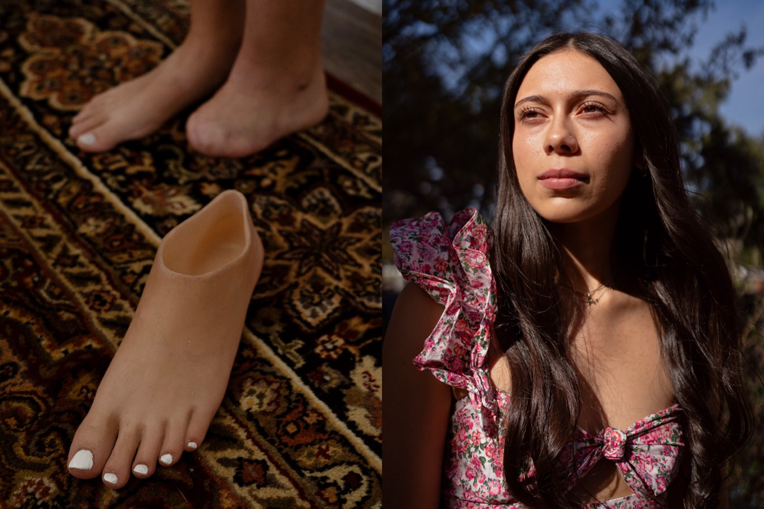 A college student fights an insurance denial to get a prosthetic foot before graduation