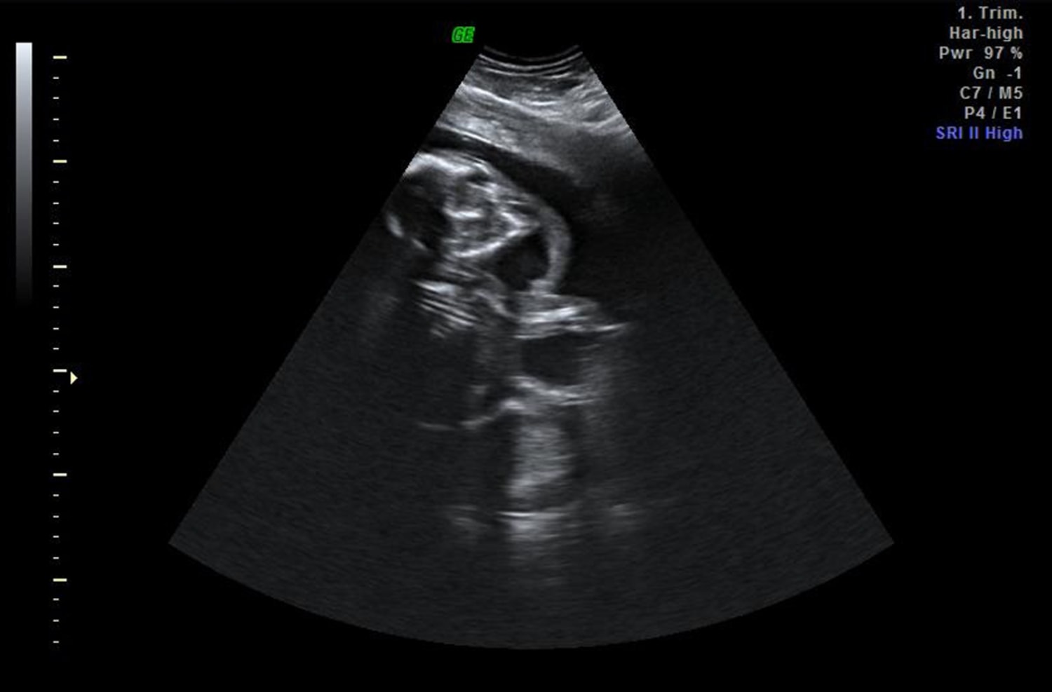 Can You Guess The Baby Animal In This Ultrasound
