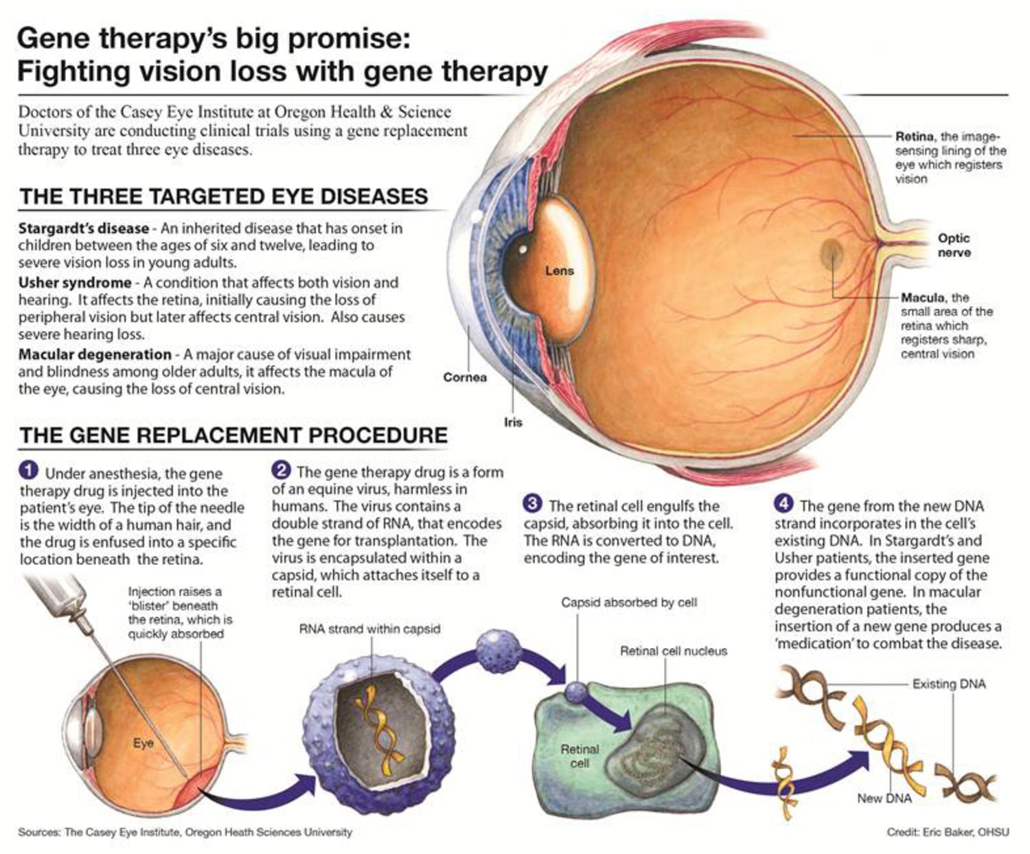 Genetics of Eyesight