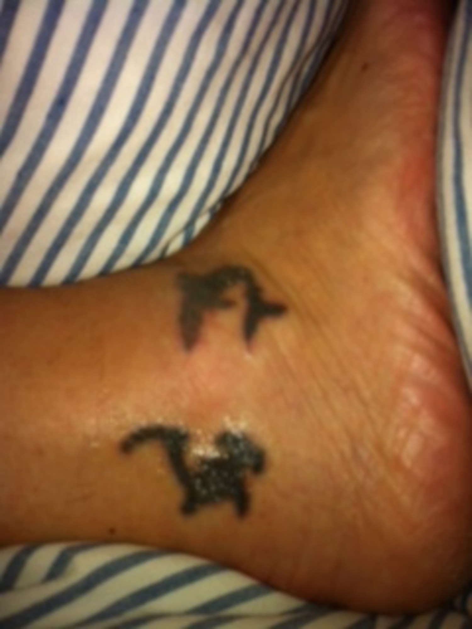 Details more than 63 tattoo removal utah  thtantai2