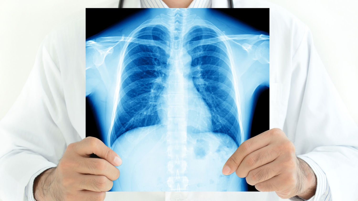 medico-con-radiografia-de-pulmones