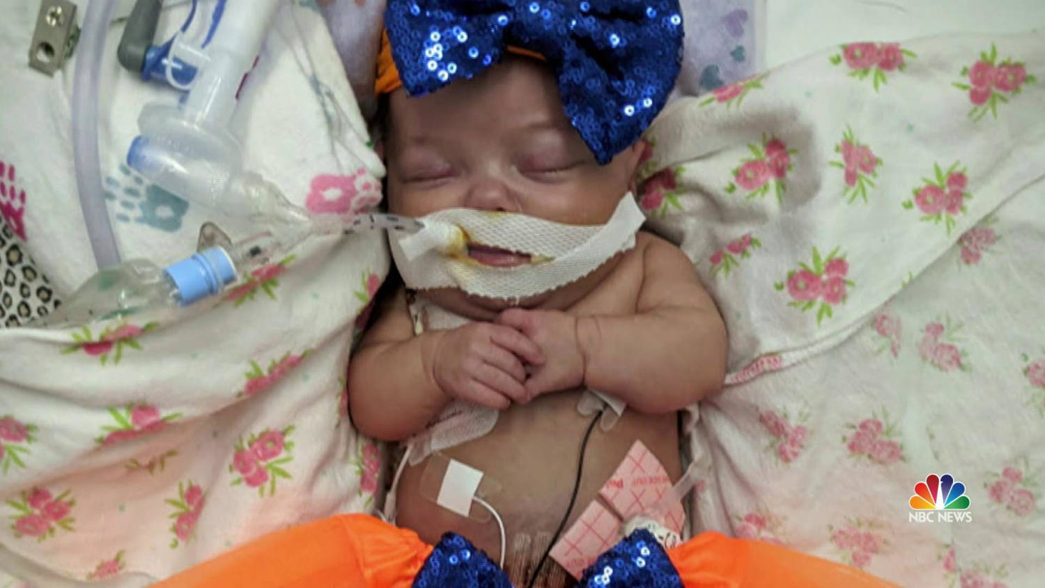 Meet 'Phillie Millie,' the NICU baby with a Philadelphia fightin' spirit at  Einstein Medical Center Montgomery - 6abc Philadelphia