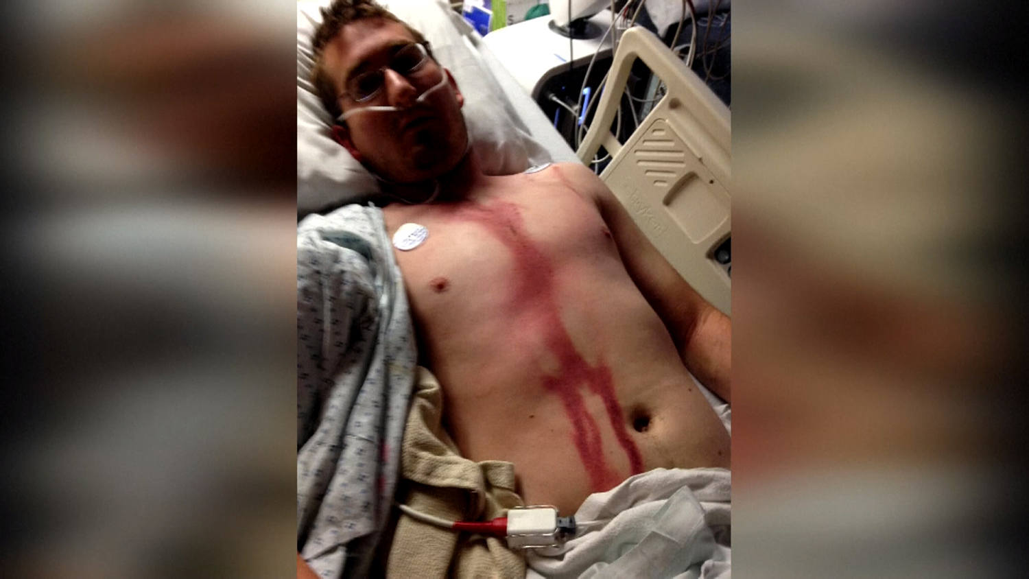  documentingreality.com Man Survives Lightning Strike