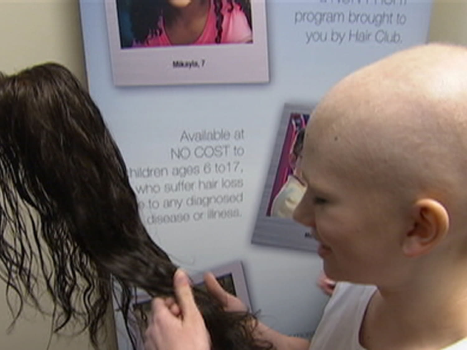 Teen girl with alopecia gets new hair