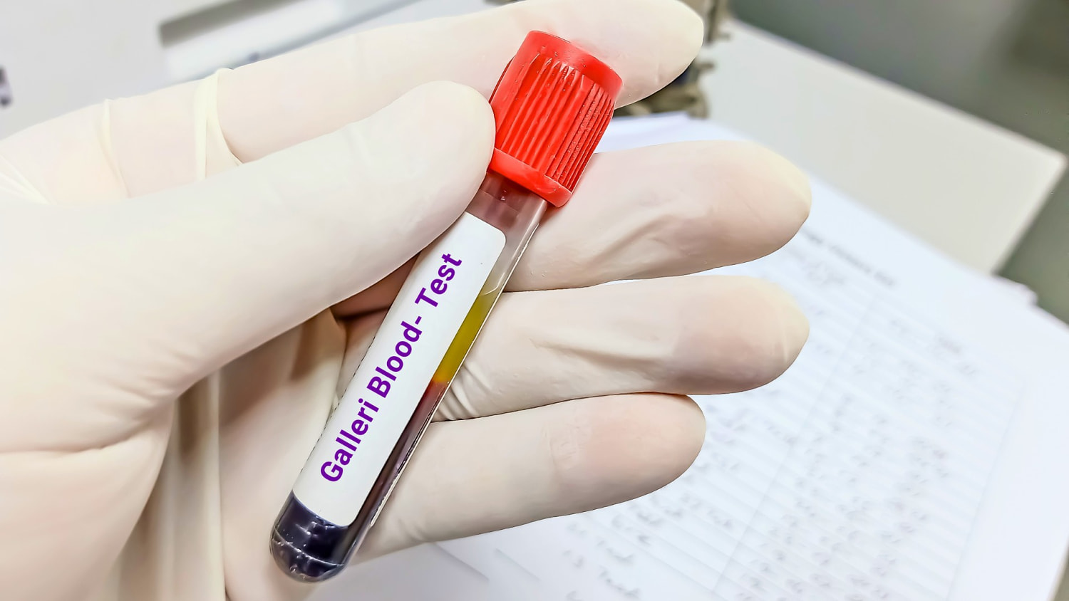 Así funciona la prueba de sangre que promete detectar signos de cáncer