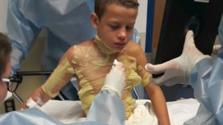 Tucson boy suffers severe burns after trying TikTok challenge